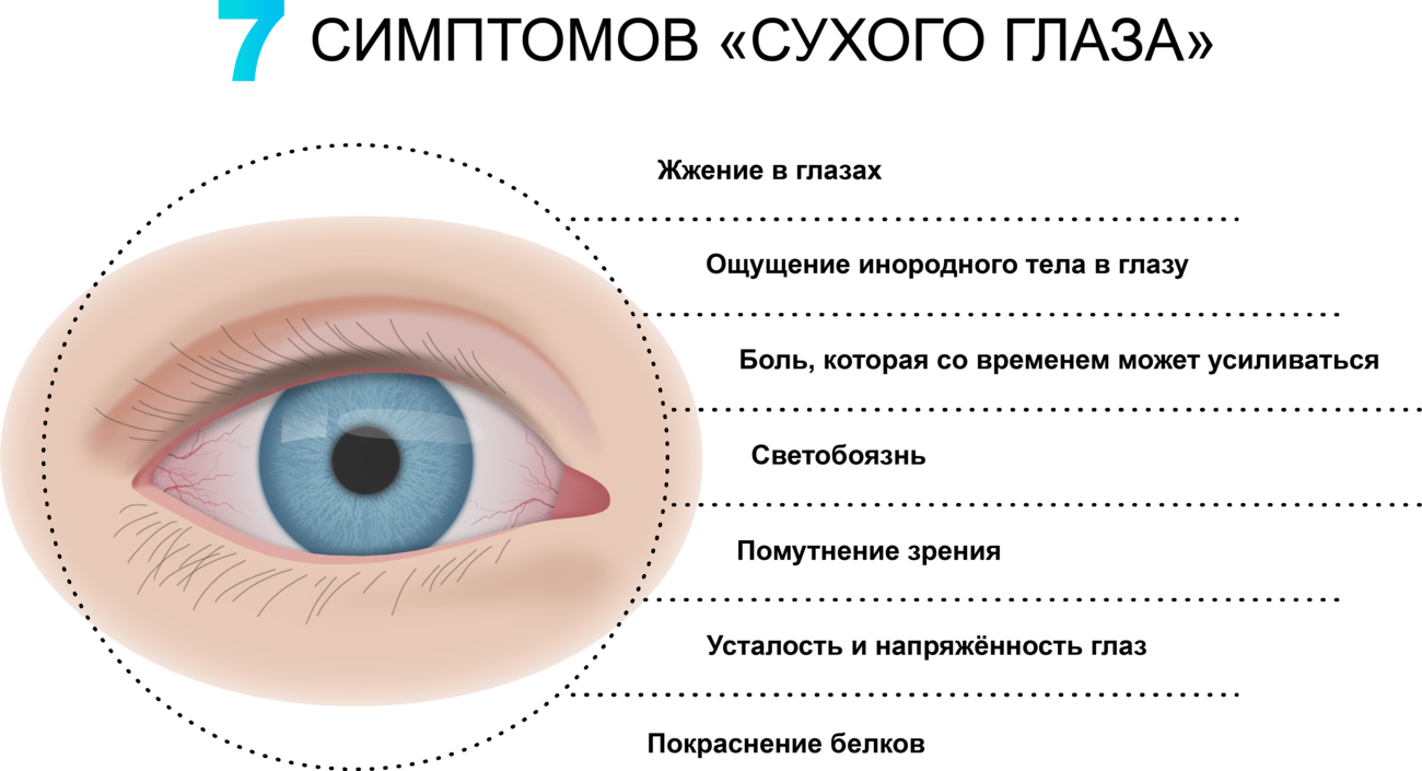 Синдром сухого глаза и астигматизм
