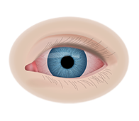 Лечение ретинита