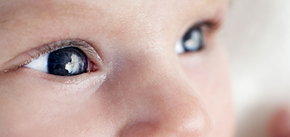 Новый способ оценки степени ретинопатии недоношенных детей