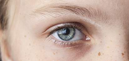 «Умный» скрининг помог выявить диабетическую ретинопатию у детей