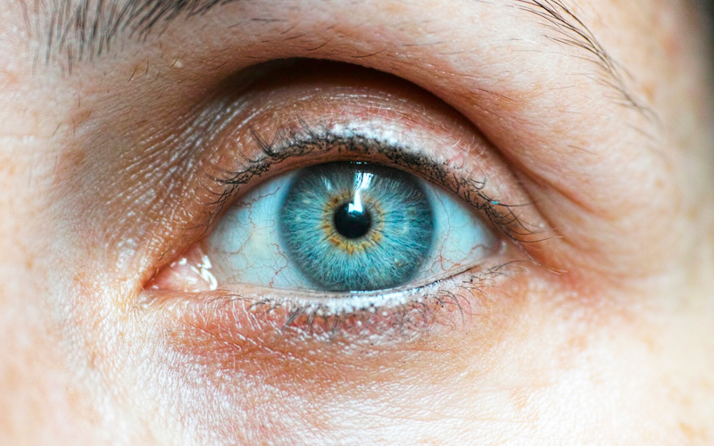 Ученые опробовали новый способ лечения синдрома сухого глаза