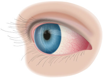 Болезни глаз у шиншилл: гноение, белые выделения, катаракта и конъюнктивит - причины, симптомы, лечение